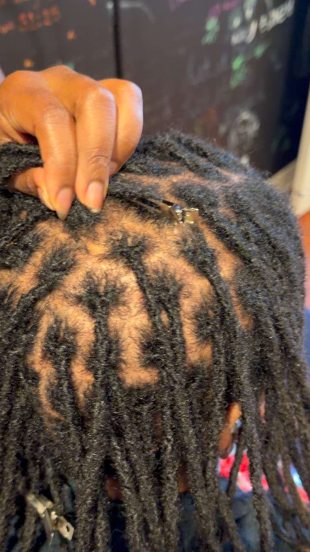 Sectioning at the root with a parting clip during installation